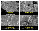 Chiropractic Killeen TX Fat Cells After Minutes