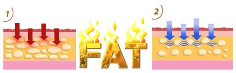Chiropractic Killeen TX Fat Cells